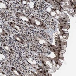 RAP30 Rabbit anti-Human, Polyclonal, Novus Biologicals:Antibodies:Primary