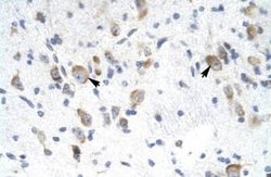 RAP30 Antibody, Novus Biologicals 0.1 mL; Unconjugated:Antibodies, Polyclonal