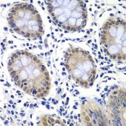 RAP30 Rabbit anti-Human, Mouse, Polyclonal, Novus Biologicals:Antibodies:Primary