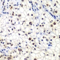 RAP30 Rabbit anti-Human, Mouse, Polyclonal, Novus Biologicals:Antibodies:Primary