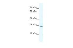 RAP30 Antibody, Novus Biologicals 0.1 mL | Buy Online | Novus Biologicals | Fisher Scientific