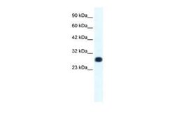 RAP30 Antibody, Novus Biologicals 0.1 mL; Unconjugated:Antibodies, Polyclonal