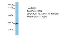 RAP30 Antibody, Novus Biologicals 0.1 mL; Unconjugated:Antibodies, Polyclonal