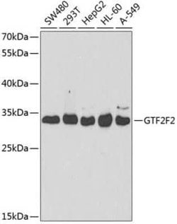 RAP30 Rabbit anti-Human, Polyclonal, Novus Biologicals:Antibodies:Primary
