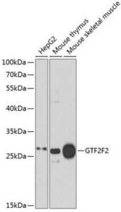 RAP30 Rabbit anti-Human, Mouse, Polyclonal, Novus Biologicals:Antibodies:Primary