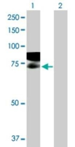RAP6 Antibody, Novus Biologicals 0.05 mg | Buy Online | Novus Biologicals | Fisher Scientific