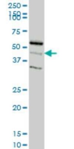 RAPGEFL1 Antibody (4G2), Novus Biologicals 0.1 mg | Buy Online | Novus Biologicals | Fisher Scientific