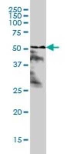 RAR alpha/NR1B1 Antibody (1C10), Novus Biologicals 0.1 mg | Buy Online | Novus Biologicals | Fisher Scientific
