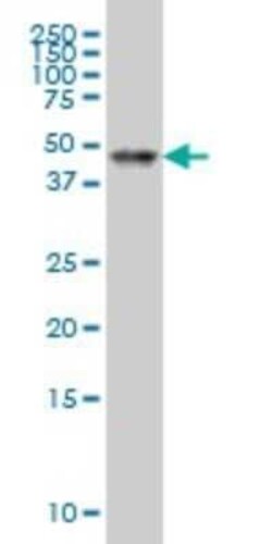 RAR alpha/NR1B1 Antibody (2D2), Novus Biologicals 0.1 mg | Buy Online | Novus Biologicals | Fisher Scientific