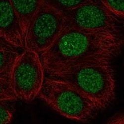 RAR alpha/NR1B1 Rabbit anti-Human, Polyclonal, Novus Biologicals:Antibodies:Primary
