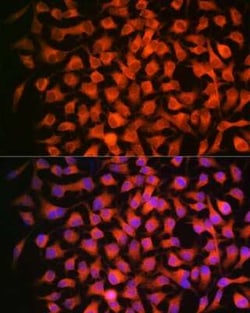 RAR beta/NR1B2 Rabbit anti-Human, Mouse, Clone: 6D5V4, Novus Biologicals:Antibodies:Primary