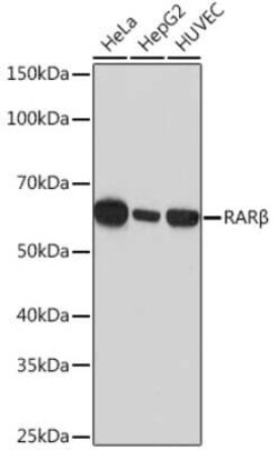 RAR beta/NR1B2 Rabbit anti-Human, Mouse, Clone: 6D5V4, Novus Biologicals:Antibodies:Primary