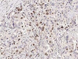 RAR beta/NR1B2 Antibody, Novus Biologicals:Antibodies:Primary Antibodies