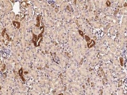 RAR beta/NR1B2 Antibody, Novus Biologicals:Antibodies:Primary Antibodies