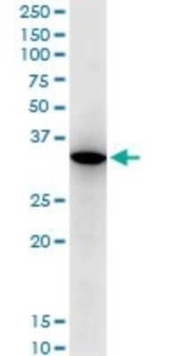 RARRES1 Antibody (2E2), Novus Biologicals 0.1 mg | Buy Online | Novus Biologicals | Fisher Scientific