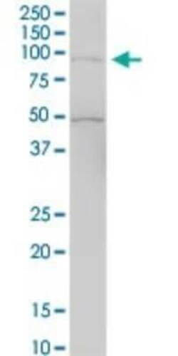 RASAL1 Antibody, Novus Biologicals 0.05 mg | Buy Online | Novus Biologicals | Fisher Scientific