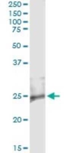 RASD2 Antibody (1C7), Novus Biologicals 0.1 mg | Buy Online | Novus Biologicals | Fisher Scientific