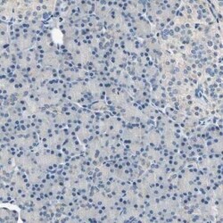 RASD2 Antibody, Novus Biologicals 25 &mu;L | Buy Online | Novus Biologicals | Fisher Scientific