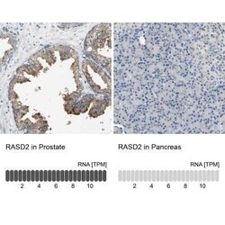 RASD2 Antibody, Novus Biologicals 25 &mu;L | Buy Online | Novus Biologicals | Fisher Scientific