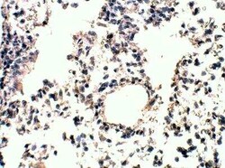 RASD2 Antibody, Novus Biologicals 100 &mu;g | Buy Online | Bio-Techne | Fisher Scientific