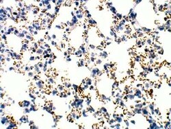 RASD2 Antibody, Novus Biologicals 100 &mu;g | Buy Online | Bio-Techne | Fisher Scientific