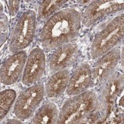 RASEF Rabbit anti-Human, Polyclonal, Novus Biologicals 100 &mu;g; Unconjugated:Antibodies,
