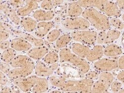 RASGRF1 Antibody, Novus Biologicals:Antibodies:Primary Antibodies