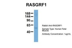 RASGRF1 Rabbit anti-Human, Polyclonal, Novus Biologicals 0.1 mL | Buy Online | Novus Biologicals | Fisher Scientific