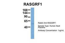 RASGRF1 Rabbit anti-Human, Polyclonal, Novus Biologicals 0.1 mL | Buy Online | Novus Biologicals | Fisher Scientific