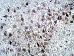 RASGRF2 Antibody, Novus Biologicals 100 &mu;g; Unconjugated:Antibodies,