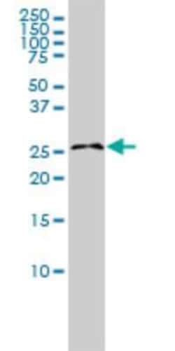 RASL11B Antibody (1B5), Novus Biologicals 0.1 mg | Buy Online | Novus Biologicals | Fisher Scientific