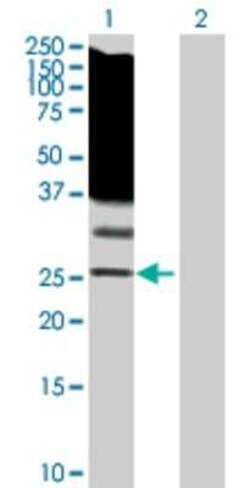 RASL11B Antibody, Novus Biologicals 0.1 mg; Unconjugated:Antibodies, Polyclonal