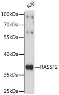 RASSF2 Antibody - Azide and BSA Free, Novus Biologicals:Antibodies:Primary