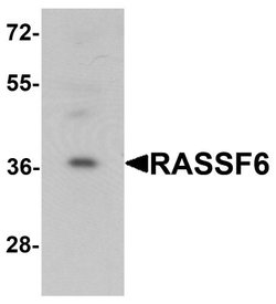 RASSF6 Antibody - BSA Free, Novus Biologicals 0.1 mg; Unconjugated:Antibodies,