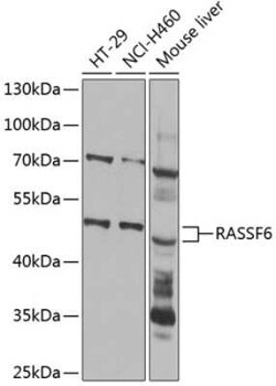 RASSF6 Antibody - BSA Free, Novus Biologicals 0.02 mL, Unconjugated:Antibodies,