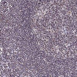 RAVER1 Antibody, Novus Biologicals 0.1 mL, Unconjugated:Antibodies, Polyclonal