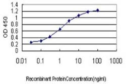 RB associated KRAB repressor Antibody (6F9), Novus Biologicals 0.1 mg;