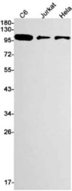 RB1 Antibody (S09-8G7), Novus Biologicals:Antibodies:Primary Antibodies