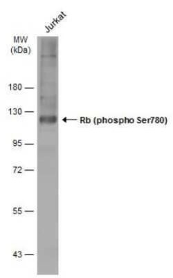 RB1, p Ser780 Antibody, Novus Biologicals 100 &mu;g | Buy Online | Novus Biologicals | Fisher Scientific