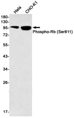 RB1, p Ser811 Antibody (S01-2G6), Novus Biologicals 100 &mu;g; Unconjugated:Antibodies,