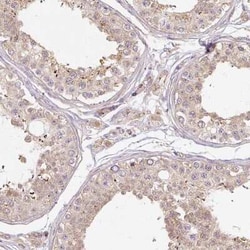 RB1CC1 Antibody, Novus Biologicals:Antibodies:Primary Antibodies
