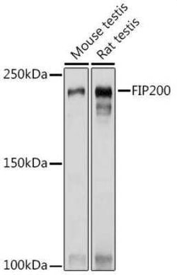 RB1CC1 Antibody - Azide and BSA Free, Novus Biologicals:Antibodies:Primary