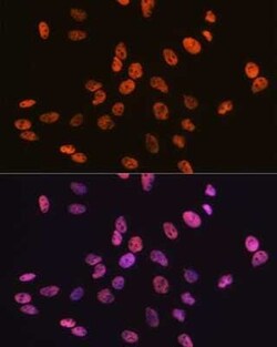 RBBP4/RbAp48 Rabbit anti-Human, Mouse, Rat, Clone: 0D1X1, Novus Biologicals