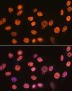 RBBP4/RbAp48 Rabbit anti-Human, Mouse, Rat, Clone: 0D1X1, Novus Biologicals