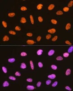 RBBP4/RbAp48 Rabbit anti-Human, Mouse, Rat, Clone: 0D1X1, Novus Biologicals
