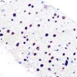 RBBP4/RbAp48 Rabbit anti-Human, Mouse, Rat, Clone: 0D1X1, Novus Biologicals