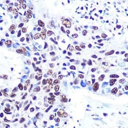 RBBP4/RbAp48 Rabbit anti-Human, Mouse, Rat, Clone: 0D1X1, Novus Biologicals
