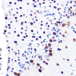 RBBP4/RbAp48 Rabbit anti-Human, Mouse, Rat, Clone: 0D1X1, Novus Biologicals