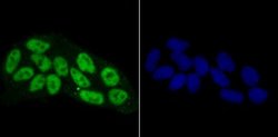 RBBP4/RbAp48 Antibody (JU37-47), Novus Biologicals 100 &mu;l; Unconjugated:Antibodies,