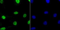RBBP4/RbAp48 Antibody (JU37-47), Novus Biologicals 100 &mu;l; Unconjugated:Antibodies,